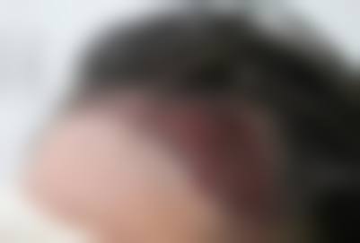 昆山大麦植发医院价格表:透明公开