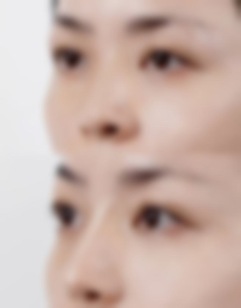 周口爱美皮肤医疗美容门诊部顾客实例
