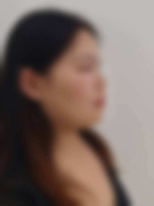 泸州美馨医学整形美容正规吗