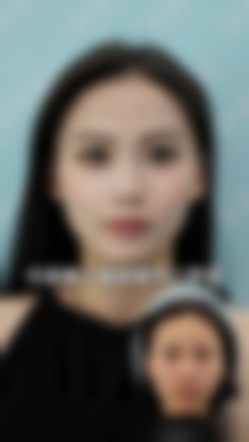 阜阳韩美美莱医疗美容门诊部顾客实例