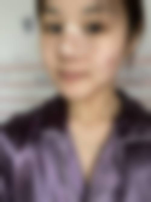镇江晶悦医疗美容门诊部顾客实例