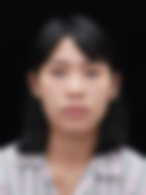 七、伊博莱整形医院怎么样：口碑好不好？附真实患者口碑评价