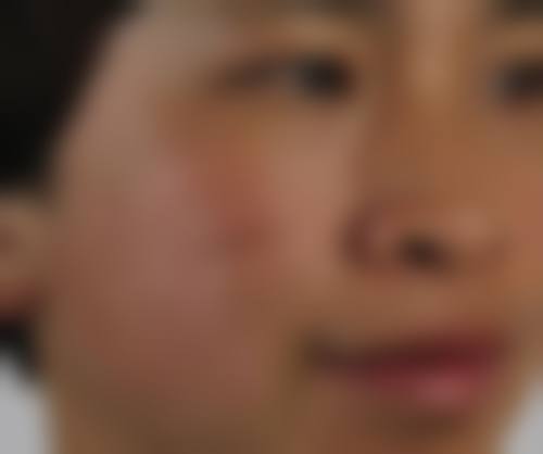 邵阳小张整形医疗美容医院项目特色