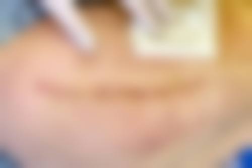 郑州延丽整形医院价格表