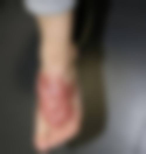 长沙珂妍医疗美容门诊部价格表