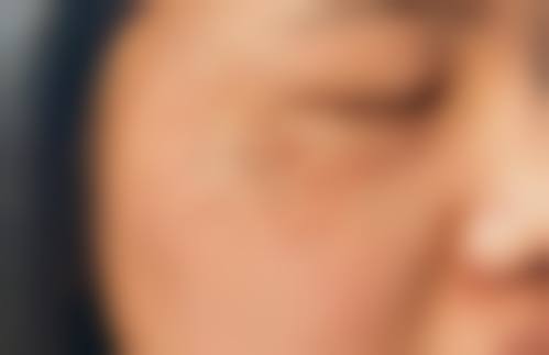 楚雄东方医疗美容诊所怎么样：顾客评价