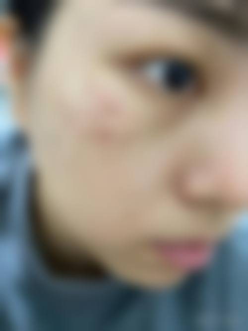 昆明延安杰西艾整形医院口碑好不好