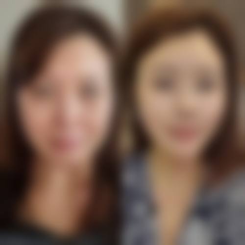 昆明延安杰西艾整形医院项目特色