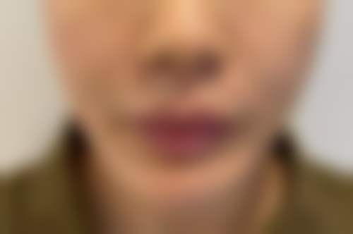 济南雅偲美容整形诊所可靠吗