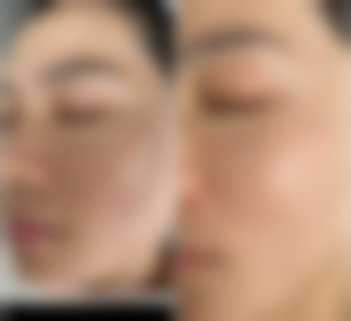 济南雅偲美容整形诊所价格表