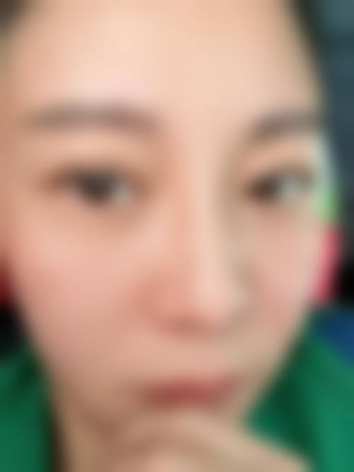 刘耿医生做手术价格