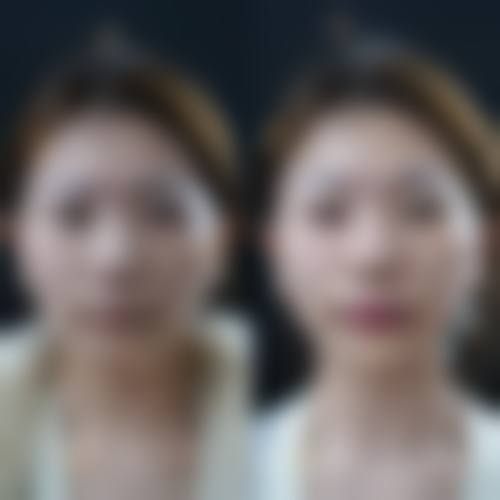 桂林叶氏嘉美整形医疗美容医院(原叶向东医疗美容整形)项目特色