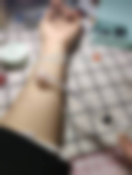 临床实例分享