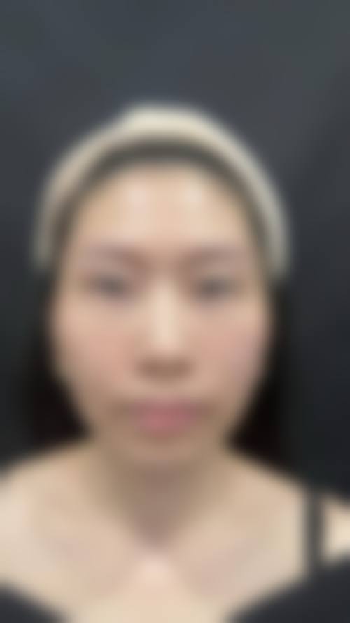 擅长项目详解