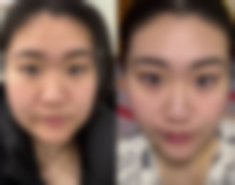 桂林叶氏嘉美整形医疗美容医院(原叶向东医疗美容整形)价格表