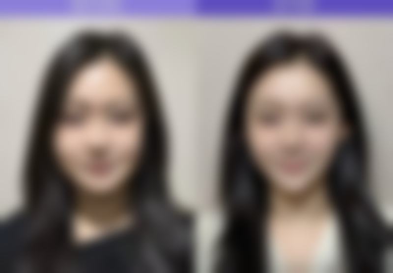 上海俪人整形美容医院项目特色