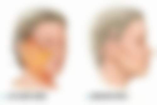 上海爱丽姿医疗美容医院真实患者口碑评价