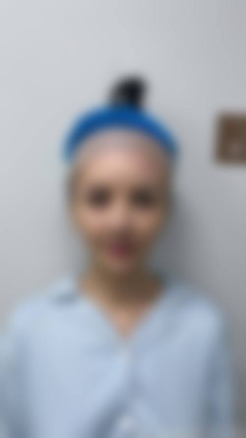 禹明久医生做手术价格
