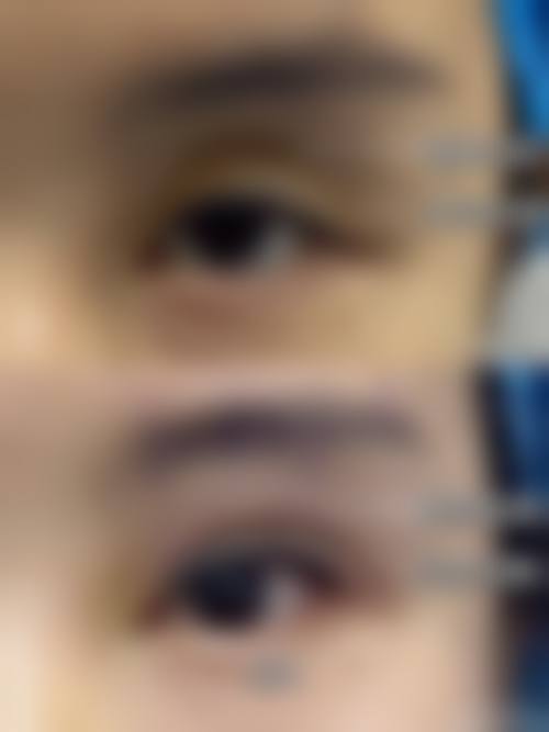预约优惠活动——现在预约柏砚农医生有什么补贴？