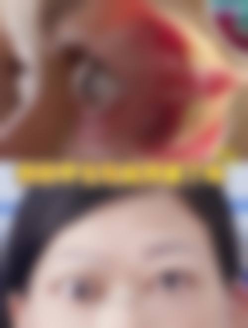 患者真实评价——大家怎么说柏砚农医生？