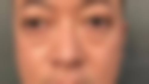 FAQ——关于柏砚农医生的常见问题