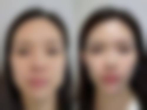 衢州梦颜清整形医院价格表