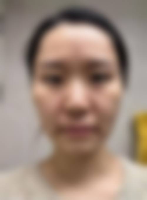 优惠活动详情:品质医美,亲民价格