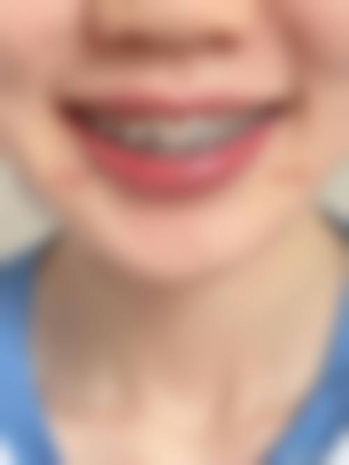 常见问题解答