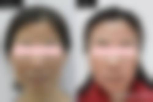 限时优惠与预约通道:开启您的变得更美计划
