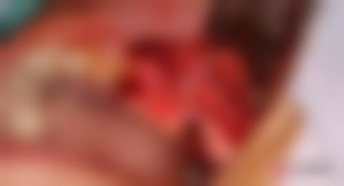 结尾:选择高密明扬齿科,让微笑更自信