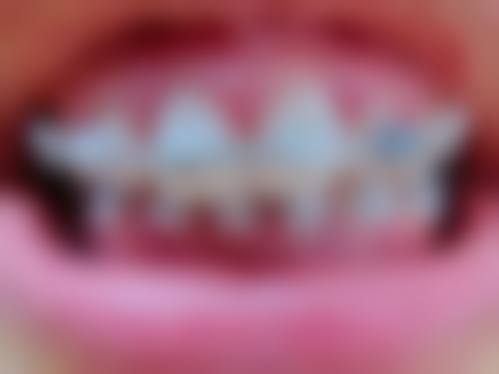 医院资质与实力:正规口腔诊所的硬核保护