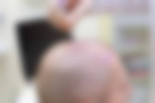 长沙湘美汇解西医疗美容门诊部顾客实例