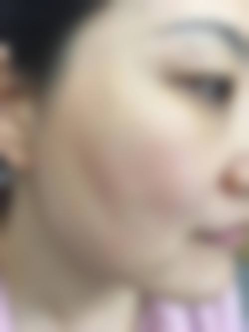 总结与预约号召