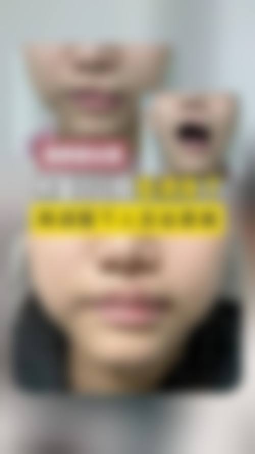 临床实例分享