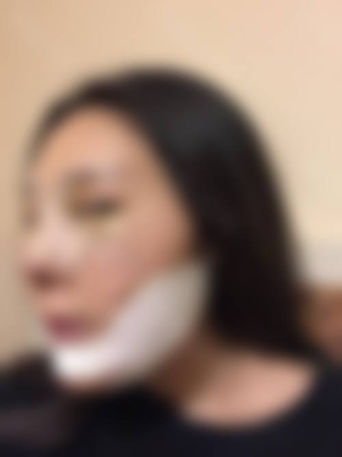 特色项目与技术优势——冰点脱毛与面部年轻化
