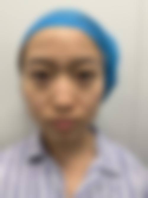 湖北十堰安琪儿医学美容门诊部顾客实例