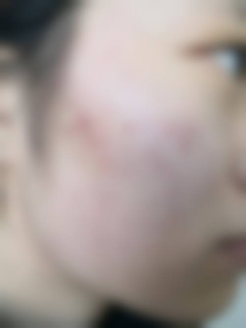北京小美微甄医疗美容诊所(小美微针轻医美顺义店)可靠吗