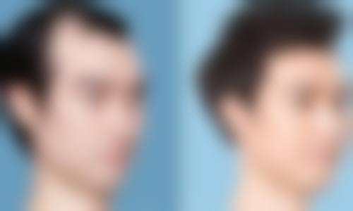 北京小美微甄医疗美容诊所(小美微针轻医美顺义店)评价