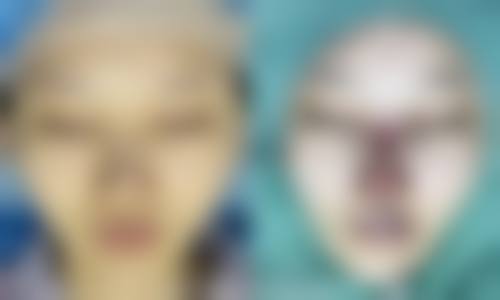 Q:优惠活动有效期多久?是否所有项目参与?