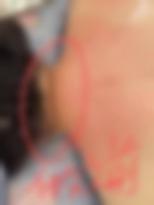 擅长项目详解:连志强医美医生