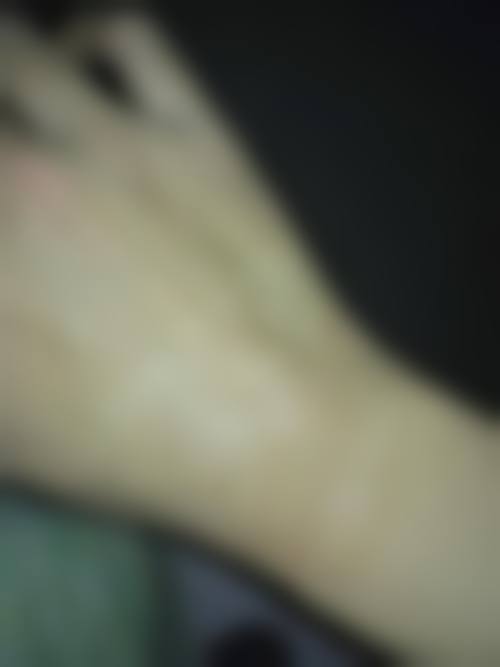 邬立新医生简介做手术价格