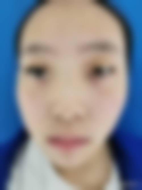 新疆自治区中医院怎么样——价格表
