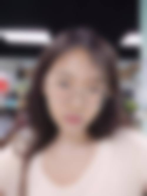 临床实例分享:上饶四季医疗美容诊所连志强