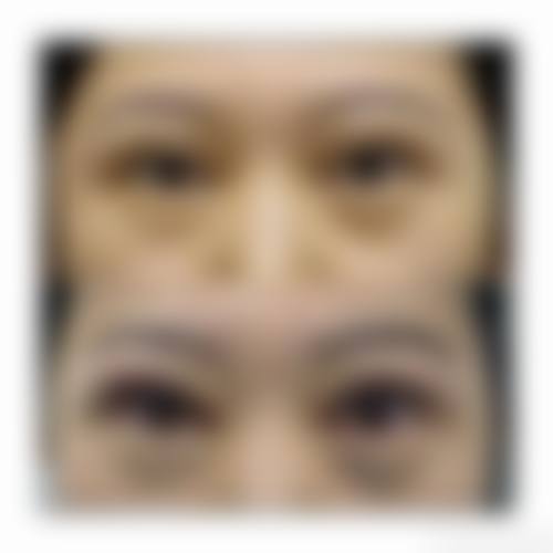 三、精良设备与医疗环境:国内外名列前茅设备,保护精细诊疗