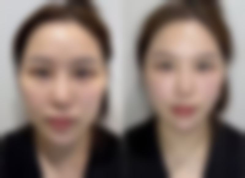 开封誉美整形医院口碑好不好