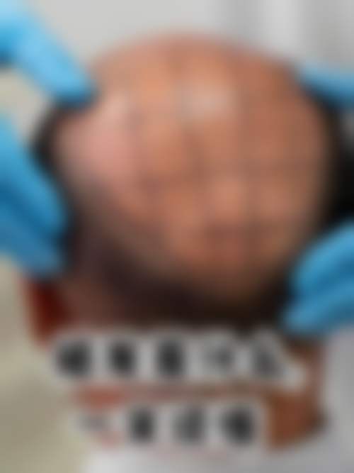 预约优惠活动