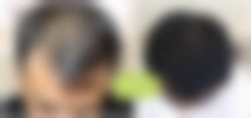擅长项目详解
