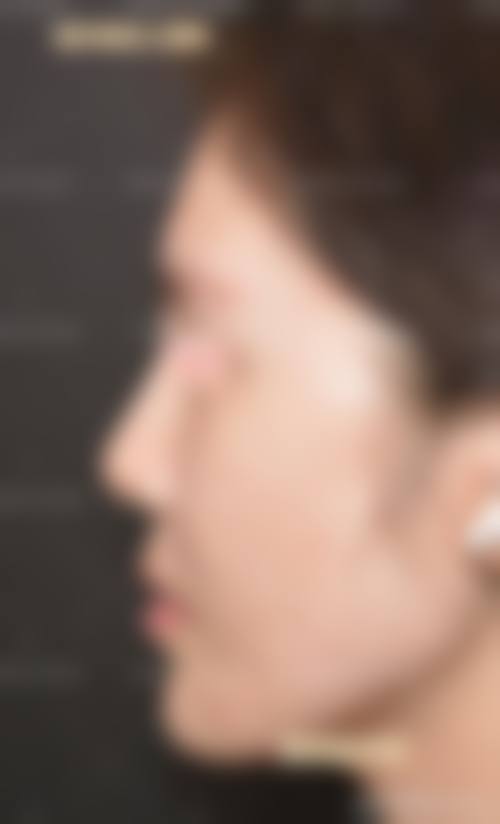 龙岩鸿熙妍医疗美容诊所擅长的手术项目