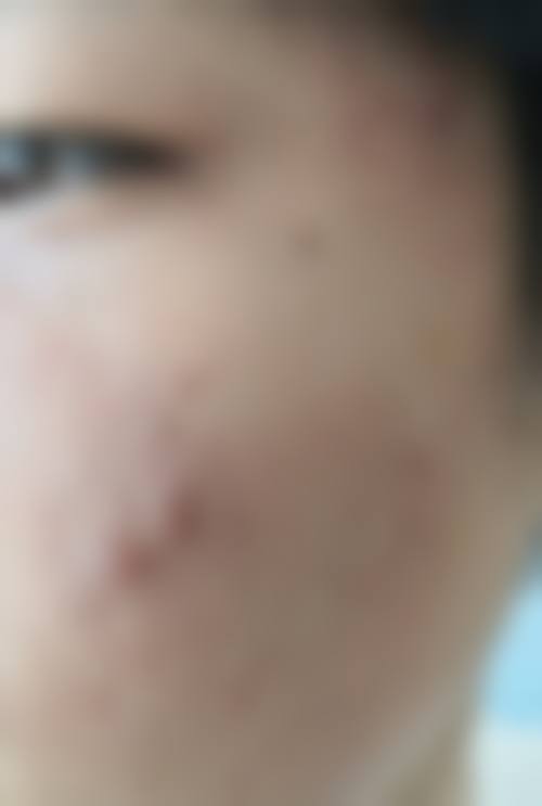 武汉雍禾植发美度医疗美容门诊部怎么样