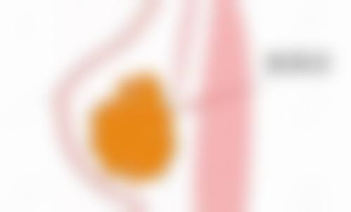 蒋淼医生顾客实例图片